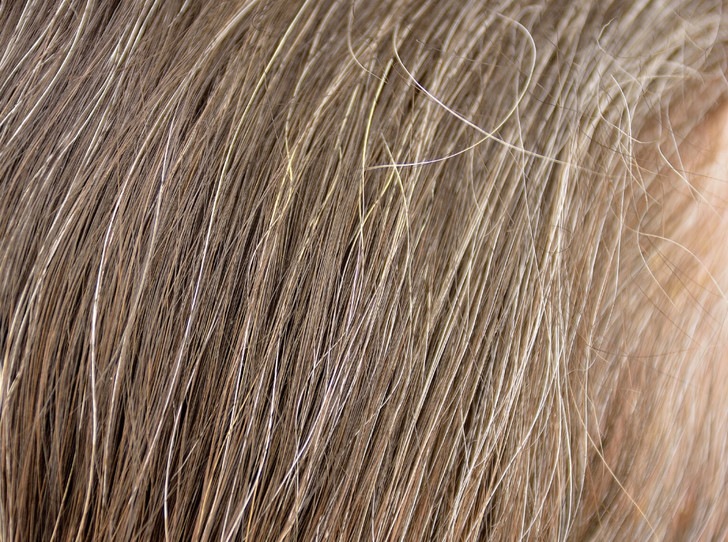 Почему волосы седеют из-за стресса и как это предотвратить